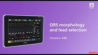 QRS morphology and lead selection at the IntelliVue patient monitor [upl. by Eldrid]