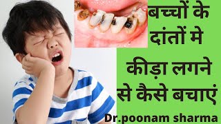 बच्चों के दांतो को कीड़ा लगने से कैसे बचाएं Primary tooth cavity बच्चों के दांतो की cavity का इलाज [upl. by Bernj513]