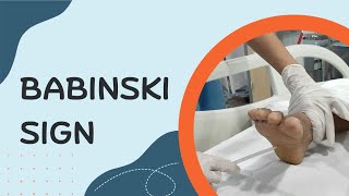 How to Elicit Babinski Sign [upl. by Llenrac]