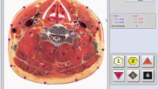 Bioplasm 10D NLS Modelo 2016 [upl. by Maressa723]