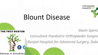 Blount Disease for Postgraduate Orthoapedic Exams [upl. by Cami]