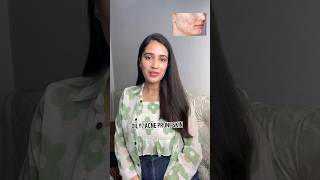 Budget friendly skincare routine for oily acne prone skin acne skincare shorts [upl. by Llorrac311]