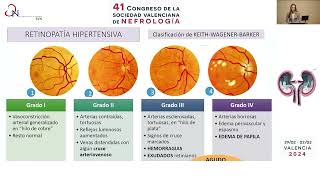 URGENCIAS HIPERTENSIVAS [upl. by Lednew862]