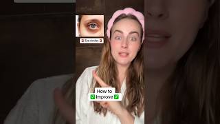 Eye circles  HOW amp WHY  ✅ springonshorts skincare skincaretips [upl. by Nnaeilsel]