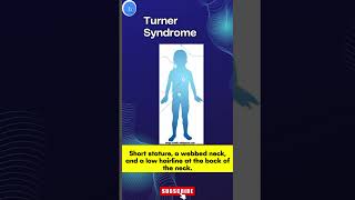 Turner Syndrome A Genetic Disorder Turner Syndrome Awareness [upl. by Elfreda]