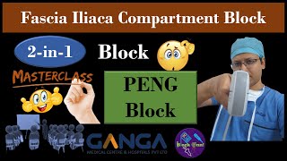 RA Masterclass Ultrasound Scanning Session  PENG Block  FICB  2in1 Block  DrTuhinM [upl. by Oiciruam]