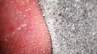 Pore Strips removal close up Blackheads removal [upl. by Sherourd]