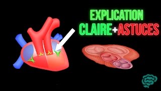 🔴 EXPLICATION CLAIRE ET ASTUCES POUR LES VALVES CARDIAQUES  DR ASTUCE [upl. by Eibmab]