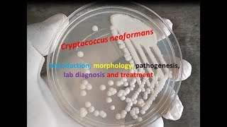 Cryptococcus neoformans Introduction morphology pathogenesis lab diagnosis and treatment [upl. by Zailer861]