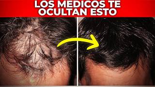 1Vitaminas Esenciales para Prevenir la Caída del Cabello [upl. by Silevi994]