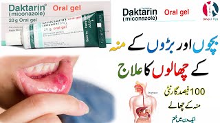 Daktarin oral gel uses benefits and side effects in urduhindi [upl. by Nochur]