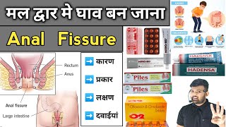 Anal Fissure  गुदा में घाव होना  Medicine  Treatment  Doctor  Pharmacy  Medicine knowledge [upl. by Green]