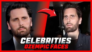 Ozempic Face Has Taken Over Hollywood  Celebrity Secrets REVEALED [upl. by Llerdnek]