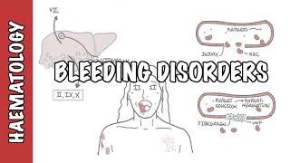 Approach to bleeding disorders  causes pathophysiology and investigations [upl. by Nysila546]