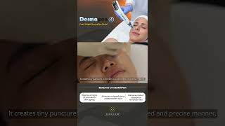 Needle Your Way to Skin Perfection with DermaPen [upl. by Fernald830]