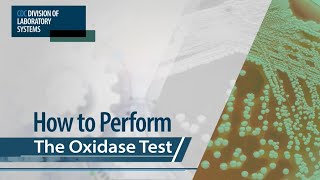 How to Perform the Oxidase Test [upl. by Columbine254]