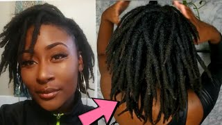 2 Year Visual Loc Journey  Before amp After Pictures [upl. by Kcuhc589]