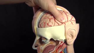 Increased ICP Intracranial Pressure Nursing Care Animation [upl. by Mushro991]