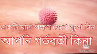 একটি মাত্র লক্ষণ দেখে বুঝে নিন আপনি গর্ভবতী কিনা। [upl. by Yesdnyl57]