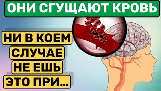 ОСТОРОЖНО  ТРОМБЫ  КАКИЕ ПРОДУКТЫ ЗАГУЩАЮТ КРОВЬ И ДЕЛАЮТ ТРОМБЫ [upl. by Stephenson]