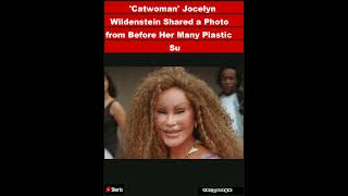 Catwoman Jocelyn Wildenstein Shared a Photo from Before Her Many Plastic Surgeries — See HShorts [upl. by Cyrille913]