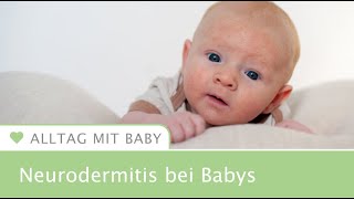 Neurodermitis bei Babys So erkennst du es [upl. by Martinson660]