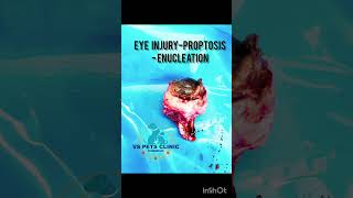 Eye injuryproptosis Enucleation [upl. by Gorey825]