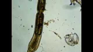 Turbellaria microscopic flatworm eating [upl. by Akenot]