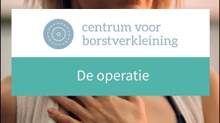 Operatie Alles over de operatie borstverkleining [upl. by Nylzzaj]