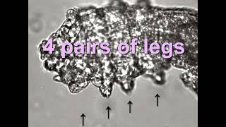 Face Mite Demodex folliculorum [upl. by Laurita]