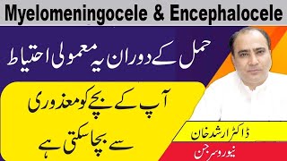 Myelomeningocele And Myelomeningocele CausesSymptoms And Treatment In Urdu [upl. by Leuname]