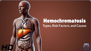 Hemochromatosis Risk Factors Are You at Risk [upl. by Kat]