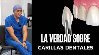 🚩 Carillas dentales ¿Negocio o Salud [upl. by Ahsitra]