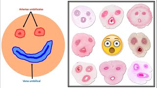 Histología del cordón umbilical junto con Dr Quetglas [upl. by Yrffej543]