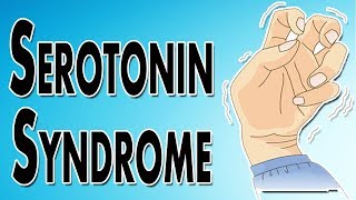 Managing Serotonin Syndrome [upl. by Enilesoj]