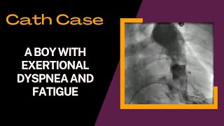 Cath Case Pulmonary Stenosis PS on ventriculography cardiology cath diagnosis [upl. by Fadden]