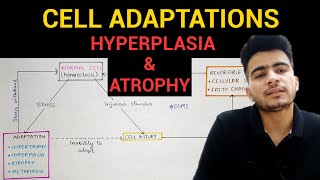 Hyperplasia amp Atrophy  Cell Adaptations 23  General Pathology  EOMS [upl. by Naruq]