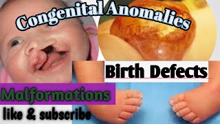 Basics of Congenital Anomalies Birth Defects Malformations [upl. by Eenaj]