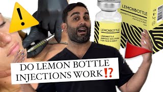 Lemon Bottle WHY YOU SHOULD AVOID IT [upl. by Aelrac160]