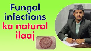 Fungal infections ka natural ilaaj  Attaullah Khan [upl. by Beaumont]