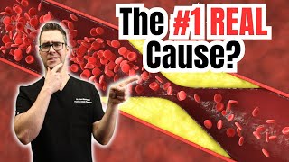 What is Heart Disease The REAL Causes [upl. by Sharity61]