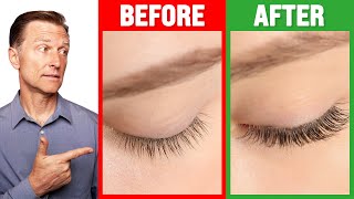 How to Grow Long Thick Eyelashes QUICKLY  Dr Berg [upl. by Lucinda77]