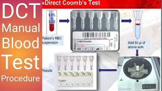 Direct Combs test [upl. by Ulphi]