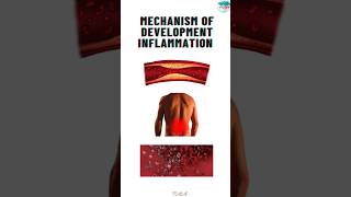 What is the mechanism of development of inflammation inflammation inflammationrelief [upl. by Kielty]