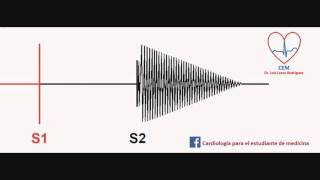 Soplo de la insuficiencia aórticaAortic Insufficiency murmur [upl. by Ymac116]