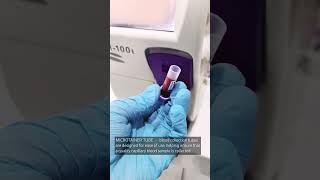 Capillary puncture blood sample for CBC [upl. by Ennailuj691]