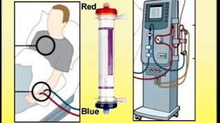 Setting Up of Dialysis Machine [upl. by Leamse]