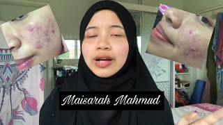 My Acne Story MaisarahMahmud [upl. by Yahiya94]