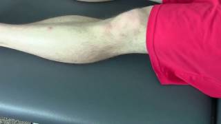 Knee Pain Hyperextension Treatemt Part 1 [upl. by Sedda987]