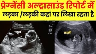 Pregnancy ultrasound se kaise pata krein ki ladka hai ya ladki [upl. by Eirallih]